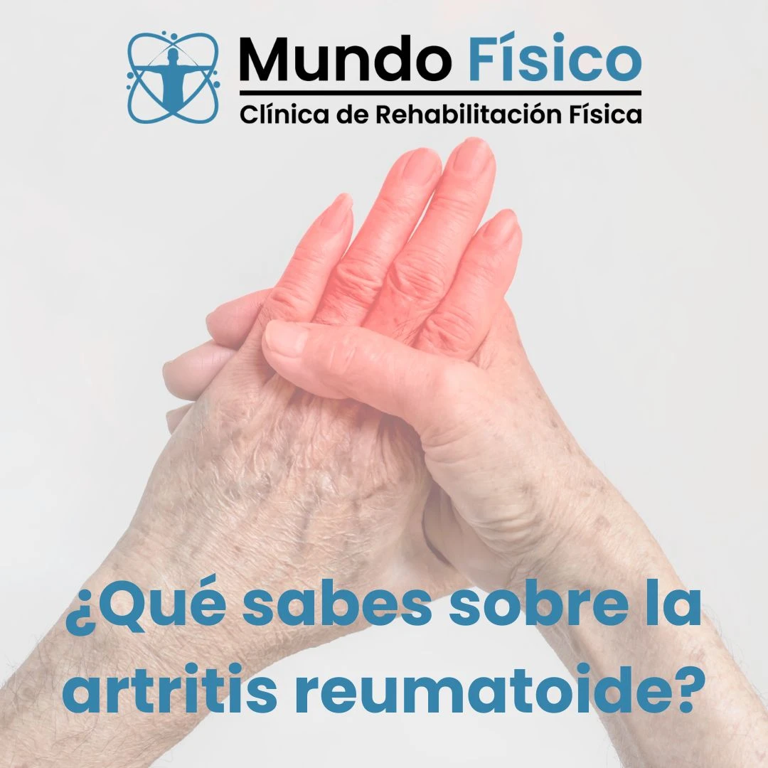 que sabes sobre la artritis reumatoide