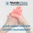 que sabes sobre la artritis reumatoide