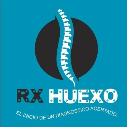 rxhueso en zapopan