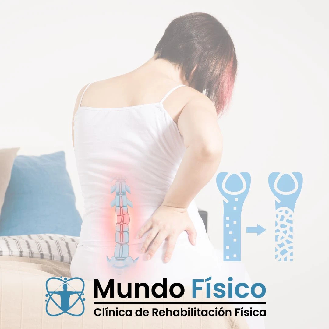tratamiento de osteoporosis zapopan